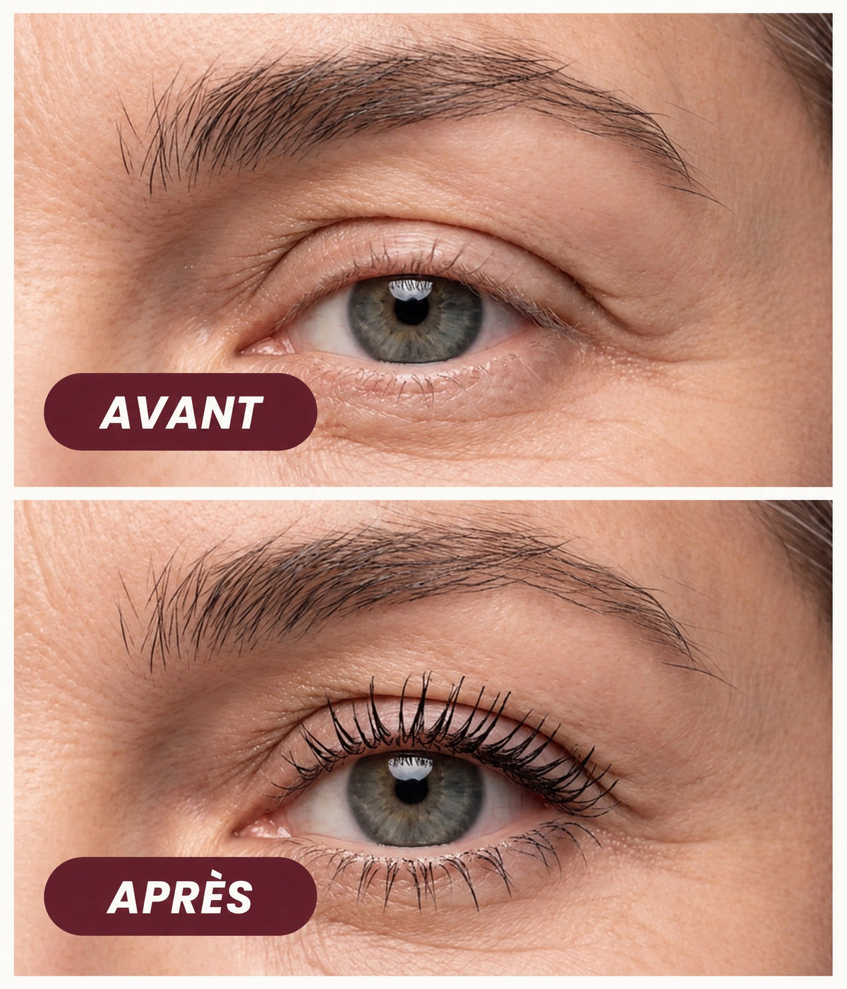 Avant et après application de Cilyora